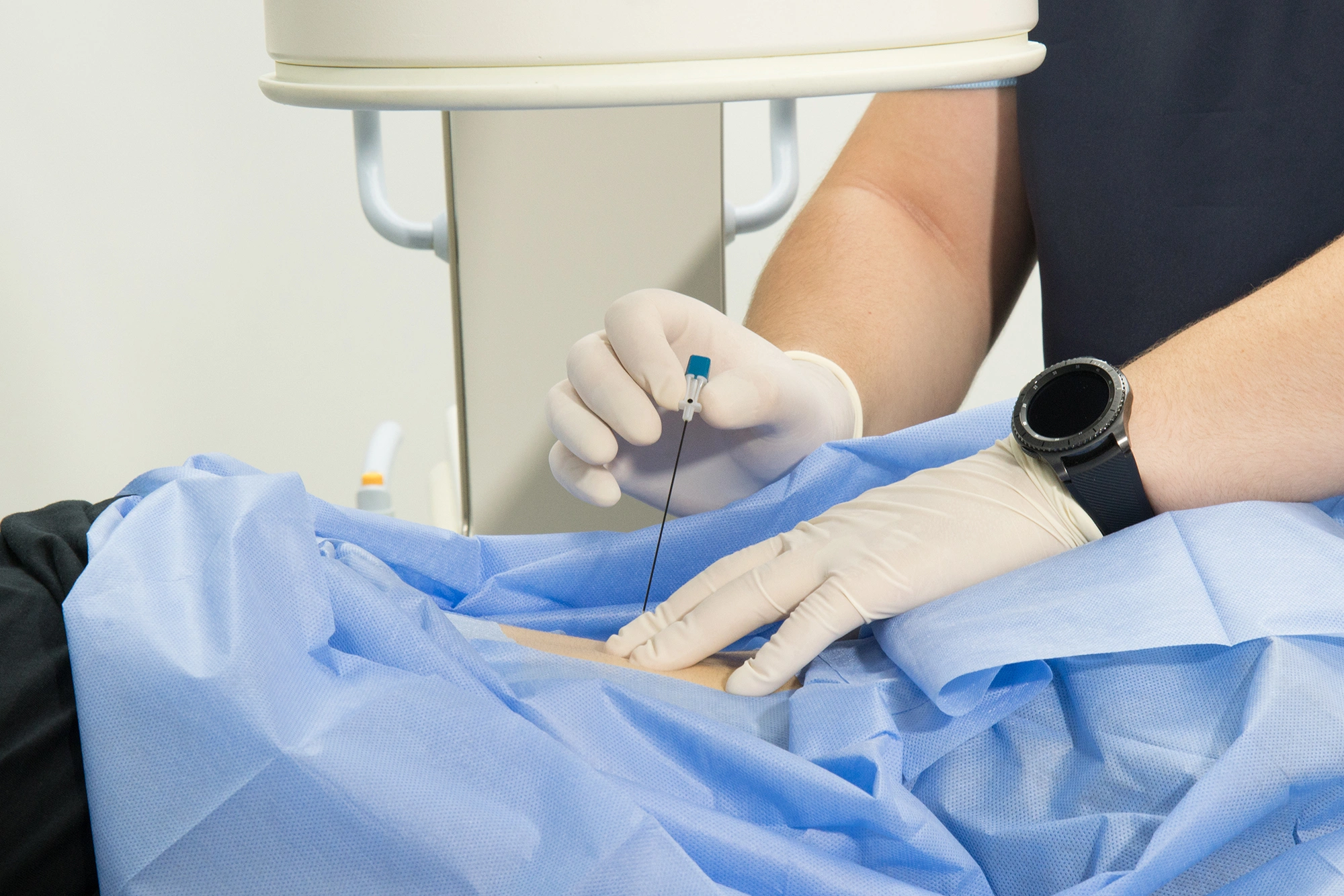 Are Sympathetic Nerve Blocks Suitable for Me?