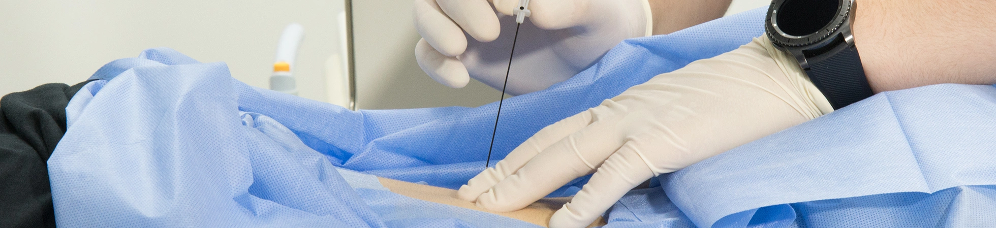 Are Sympathetic Nerve Blocks Suitable for Me?