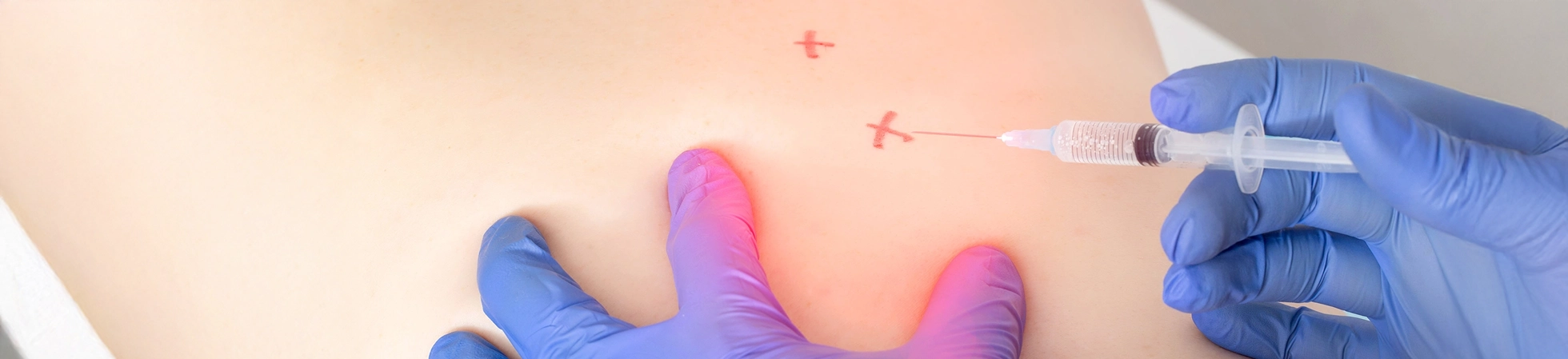 Doctor using trigger point injection on a patient’s back