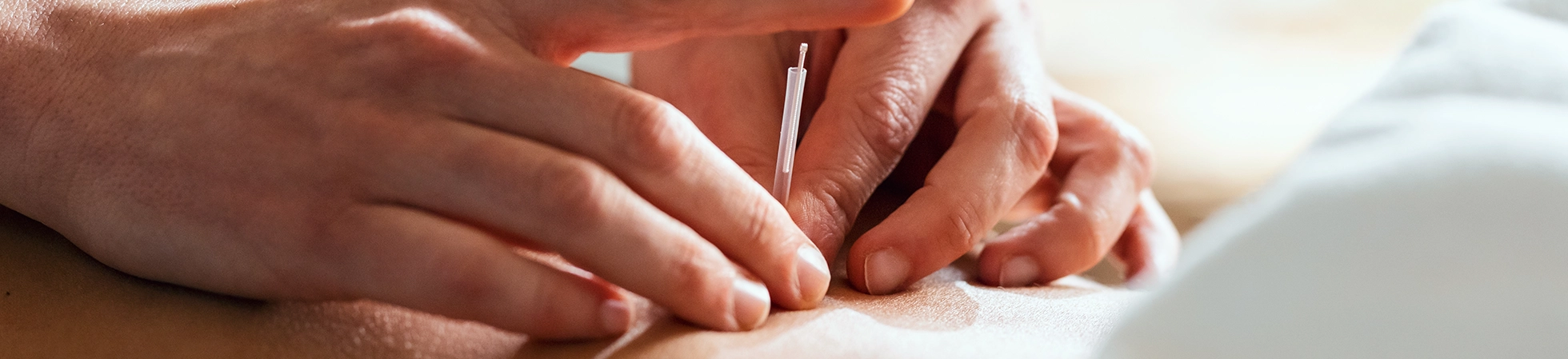 Trigger Point Injections: What to Expect and Who Benefits Most