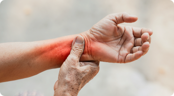 How to Manage Arthritis Pain Effectively