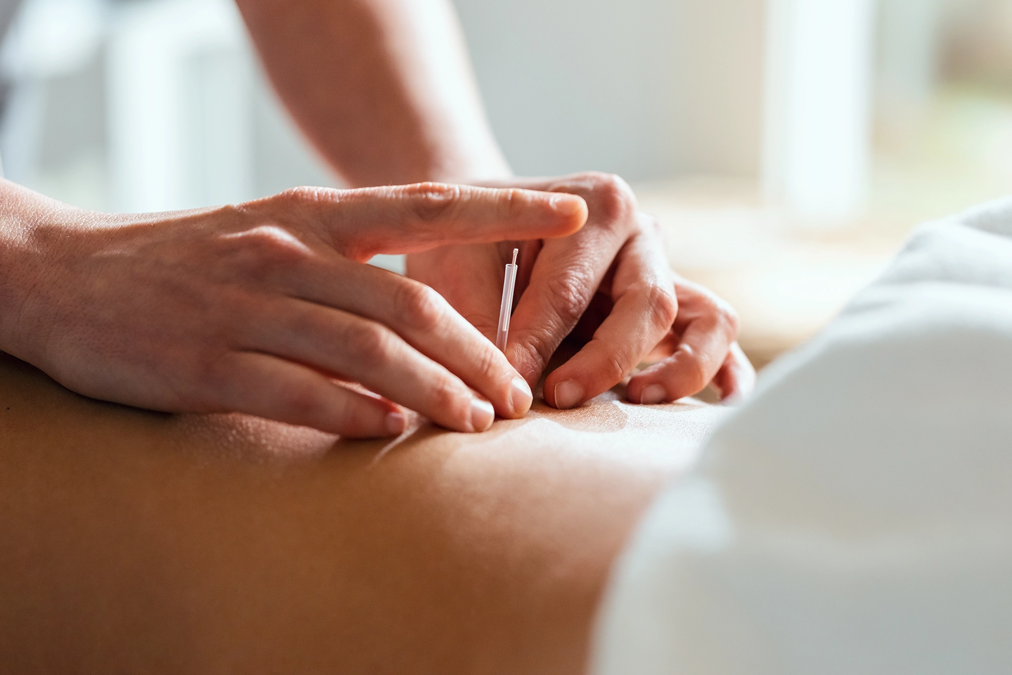 Pain management doctor performing a trigger point injection to relieve pain and release tight muscle knots.