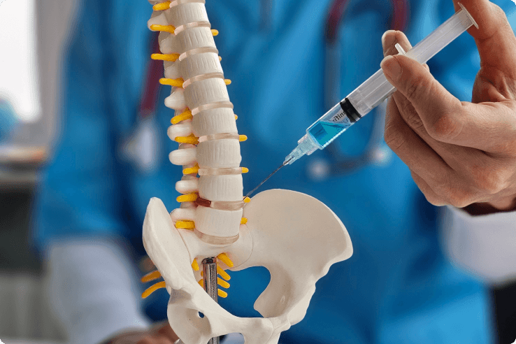 Steps involved in nucleoplasty procedure