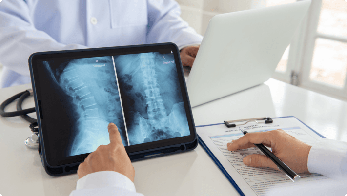 Patient recovery after nucleoplasty