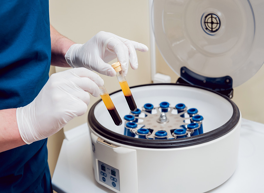 Steps involved in annuloplasty procedure