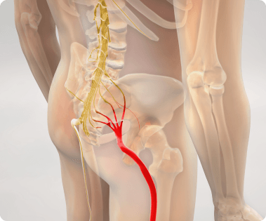 Illustration of sciatica nerve anatomy