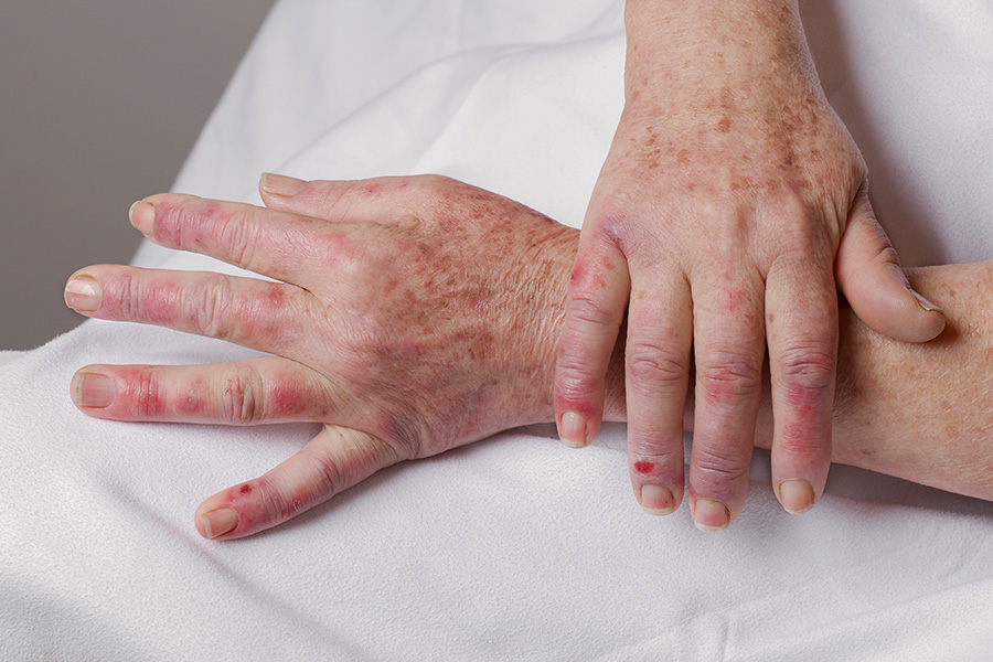 Person experiencing trigger point injections symptoms