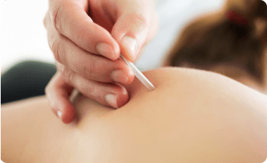 Illustration of trigger point injections nerve anatomy